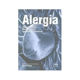 Alergia