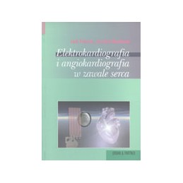 Elektrokardiografia i...