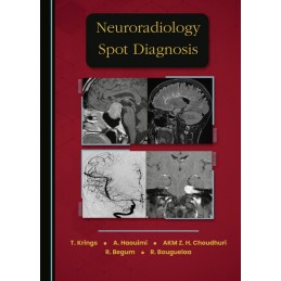 Neuroradiology Spot Diagnosis