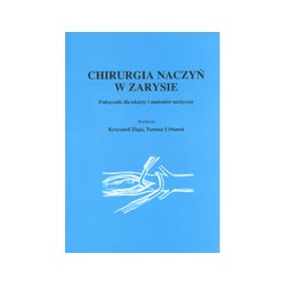 Chirurgia naczyń w zarysie