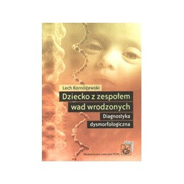 Dziecko z zespołem wad...