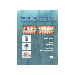IMPLANTOLOGIA ESTETYCZNA -...