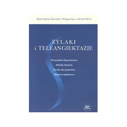 Żylaki i teleangiektazje