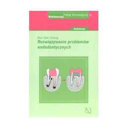 Rozwiązywanie problemów...