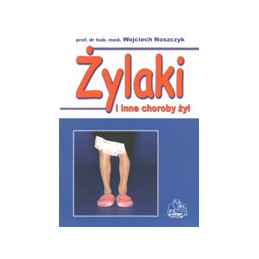 Żylaki i inne choroby żył