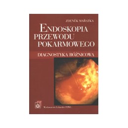 Endoskopia przewodu...