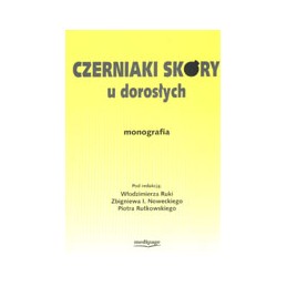 Czerniaki skóry u dorosłych