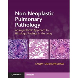 Non-Neoplastic Pulmonary...