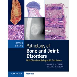 Pathology of Bone and Joint...