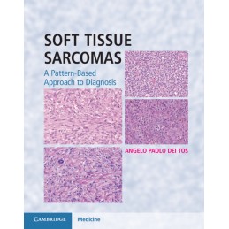 Soft Tissue Sarcomas...