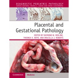 Placental and Gestational...