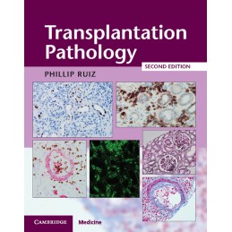 Transplantation Pathology...