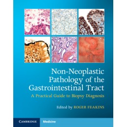 Non-Neoplastic Pathology of...