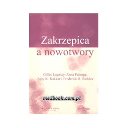 Zakrzepica a nowotwory