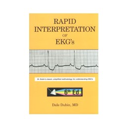 Rapid interpretation of EKG's