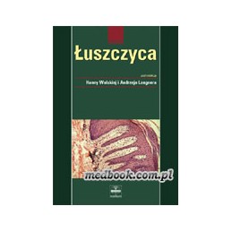 Łuszczyca