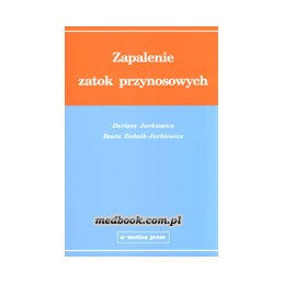 Zapalenie zatok przynosowych