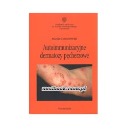 Autoimmunizacyjne dermatozy...
