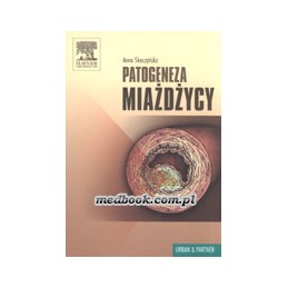 Patogeneza miażdżycy