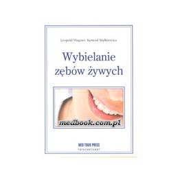 Wybielanie zębów żywych
