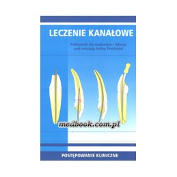 Leczenie kanałowe -...