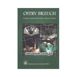 Ostry brzuch