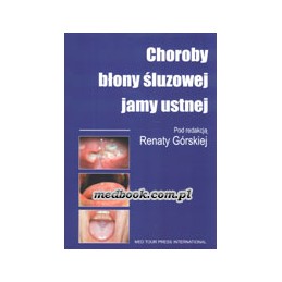 Choroby błony śluzowej jamy...