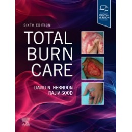 Total Burn Care