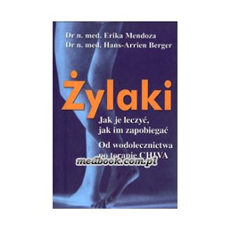 ŻYLAKI - jak je leczyć, jak...
