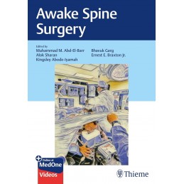 Awake Spine Surgery