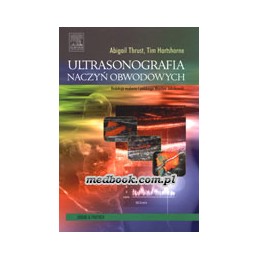 Ultrasonografia naczyń...