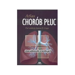 Atlas chorób płuc