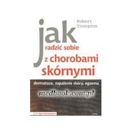 Jak radzić sobie z...