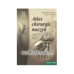 Atlas chirurgii naczyń