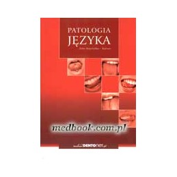 Patologia języka
