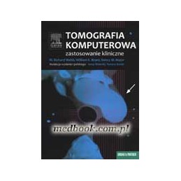 Tomografia komputerowa -...