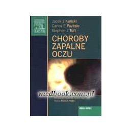 Choroby zapalne oczu