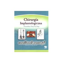 Chirurgia Implantologiczna:...