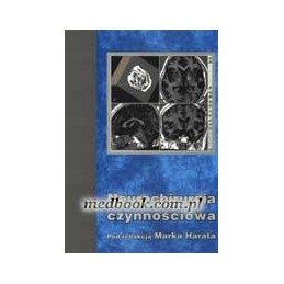 Neurochirurgia czynnościowa
