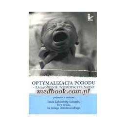Optymalizacja porodu