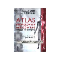 Atlas prawidłowych obrazów...