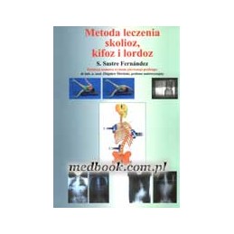 Metoda leczenia skolioz,...