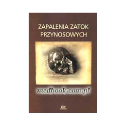 Zapalenia zatok przynosowych