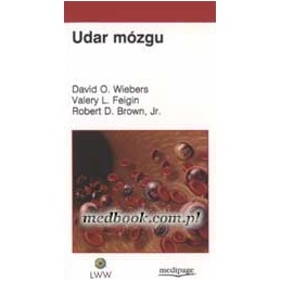 Udar mózgu