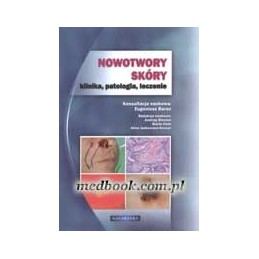 NOWOTWORY SKÓRY - klinika,...