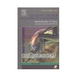 Leczenie chorób żył kończyn...