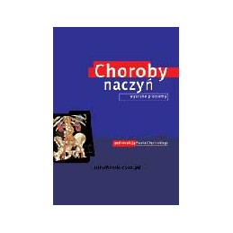 Choroby naczyń