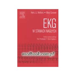 EKG w stanach nagłych