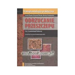 Odrzucanie przeszczepu