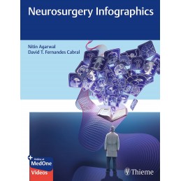 Neurosurgery Infographics